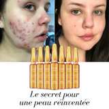 Sérum blanchissant pour une peau sans taches ( Boîte de 7 ampoules )